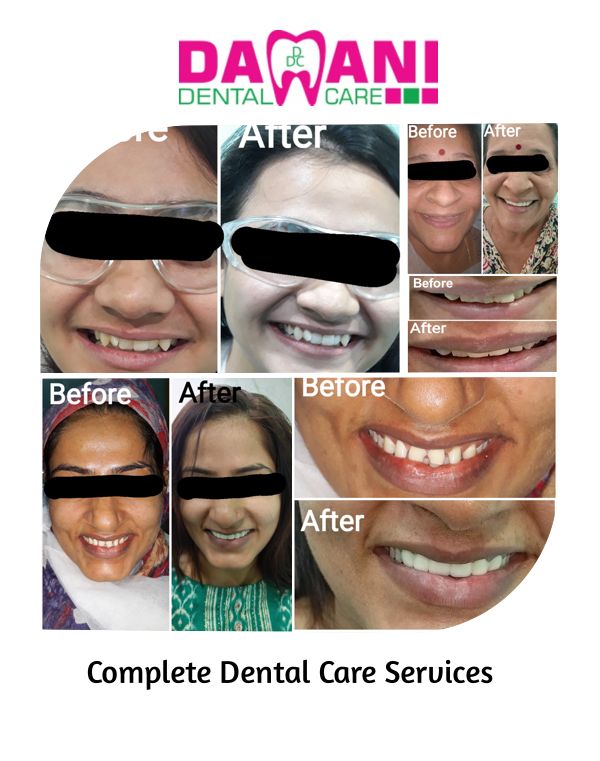 Complete Dental Care